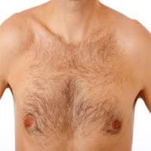 Ms17