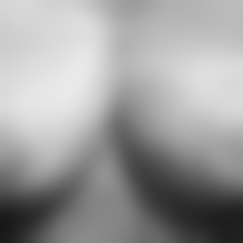 fortwouem23