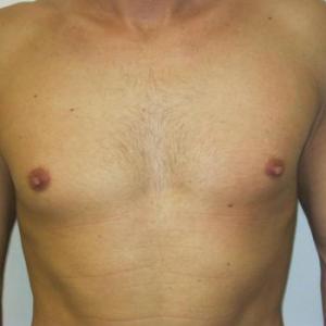 runners_body