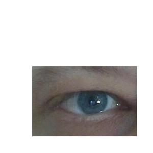 lipper-sucht