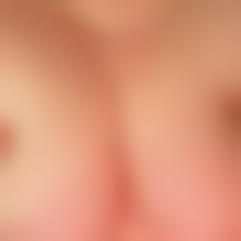 Schnackel87