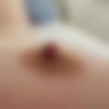 BlaseHase80
