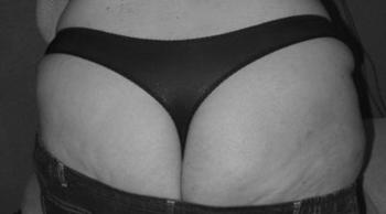 XXLmaus26