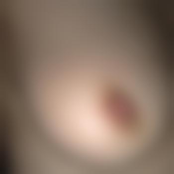 HotLips21
