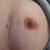 112Norderblasehase