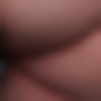 Nugggggel