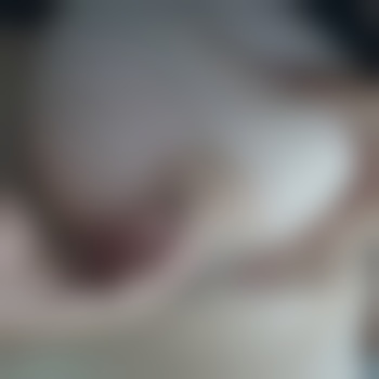 GCupundlongD