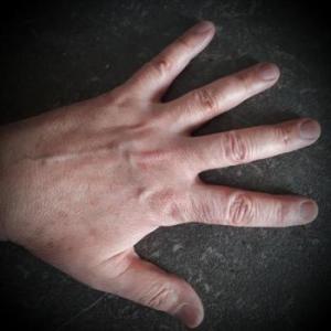 Aktknipser