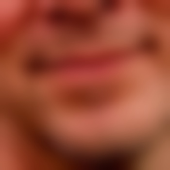 BlowLips_