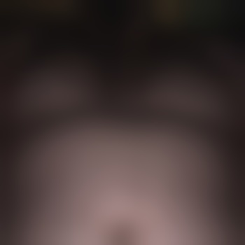 Dererny83