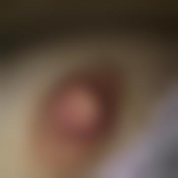 HotLips21