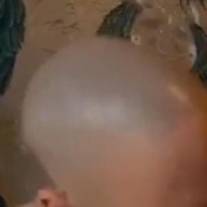 Glatzen / shorthair in MItteldeutschland