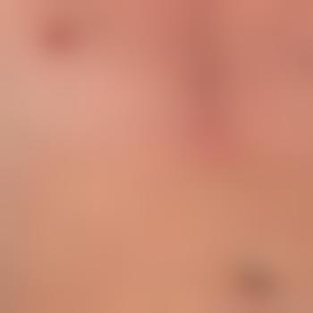 Bi__Hausfreund