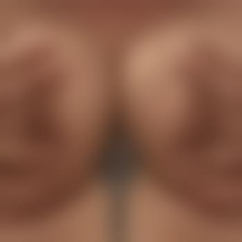 MolligesDuo69